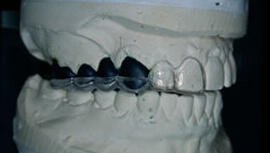 Surgical stent preparation